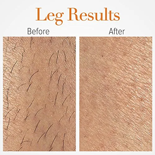 LumaRx Full Body IPL Hair Removal Device for Face & Body